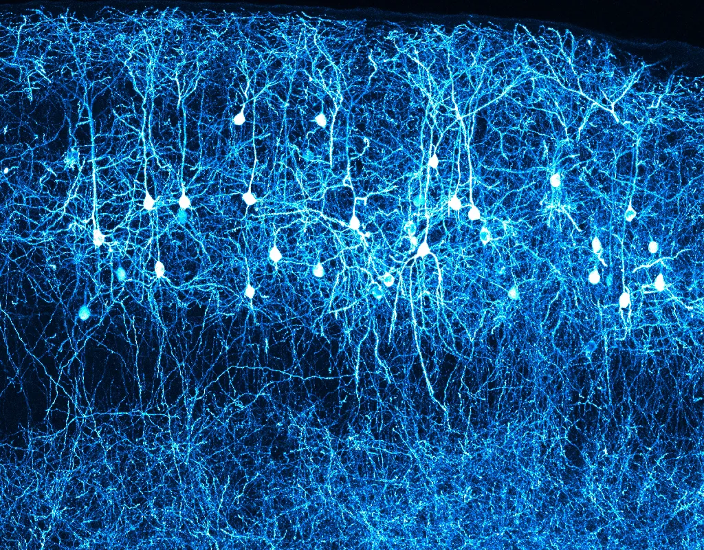 Micrograph of a layer of pyramidal neurons in the neocortex.