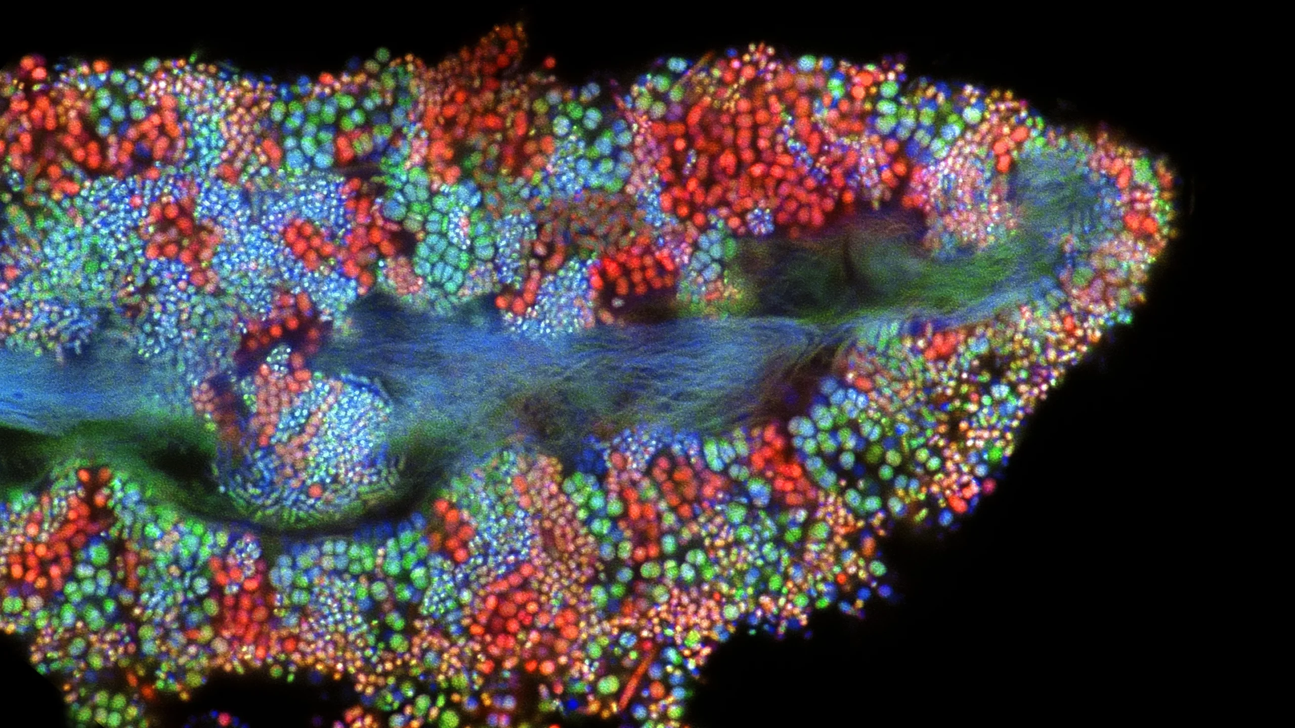 Bacterial biofilm growing on a human tongue cell.