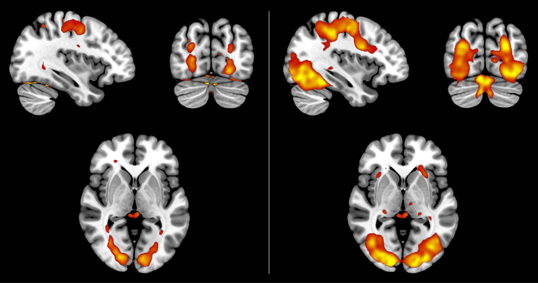 Is It Real Or Imagined? How Your Brain Tells The Difference. | Quanta ...