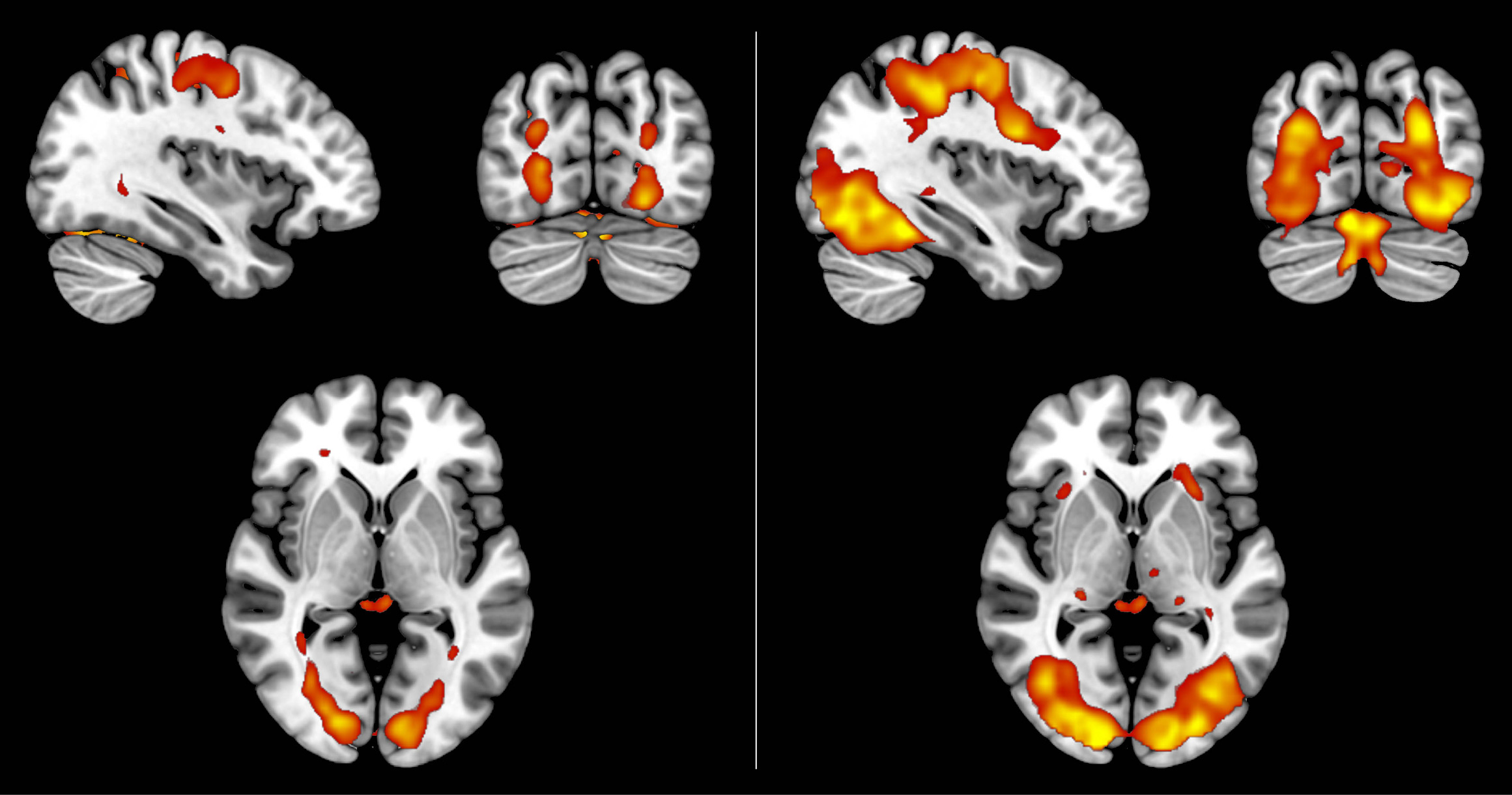 Sets of brain scan data showing comparable activity during perceived and imagined events.