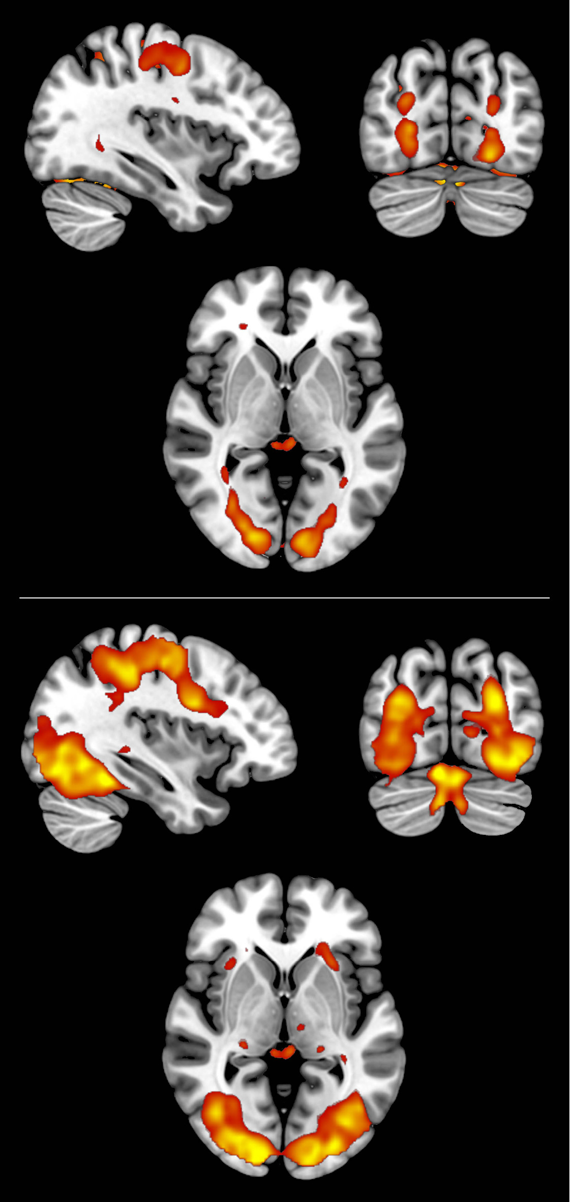 Sets of brain scan data showing comparable activity during perceived and imagined events.