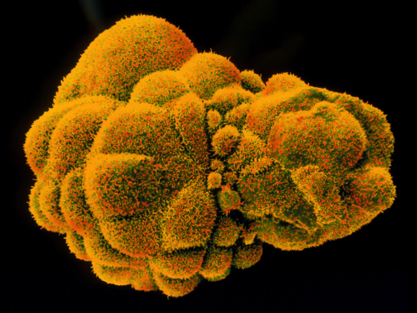 Scanning electron micrograph, colored orange, of human blastocyst at day 6.