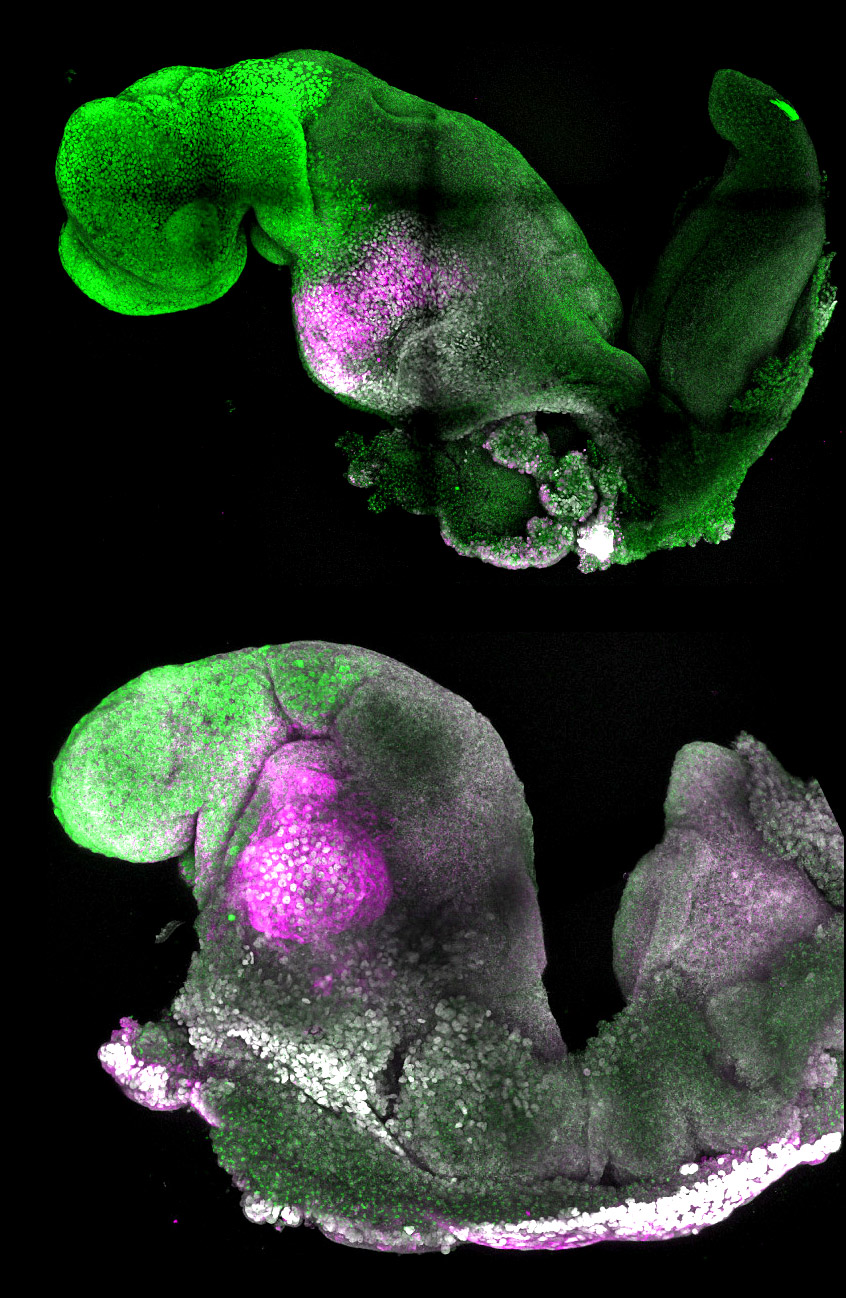 Immunologically stained mouse embryo and mouse embryo model against a black background.