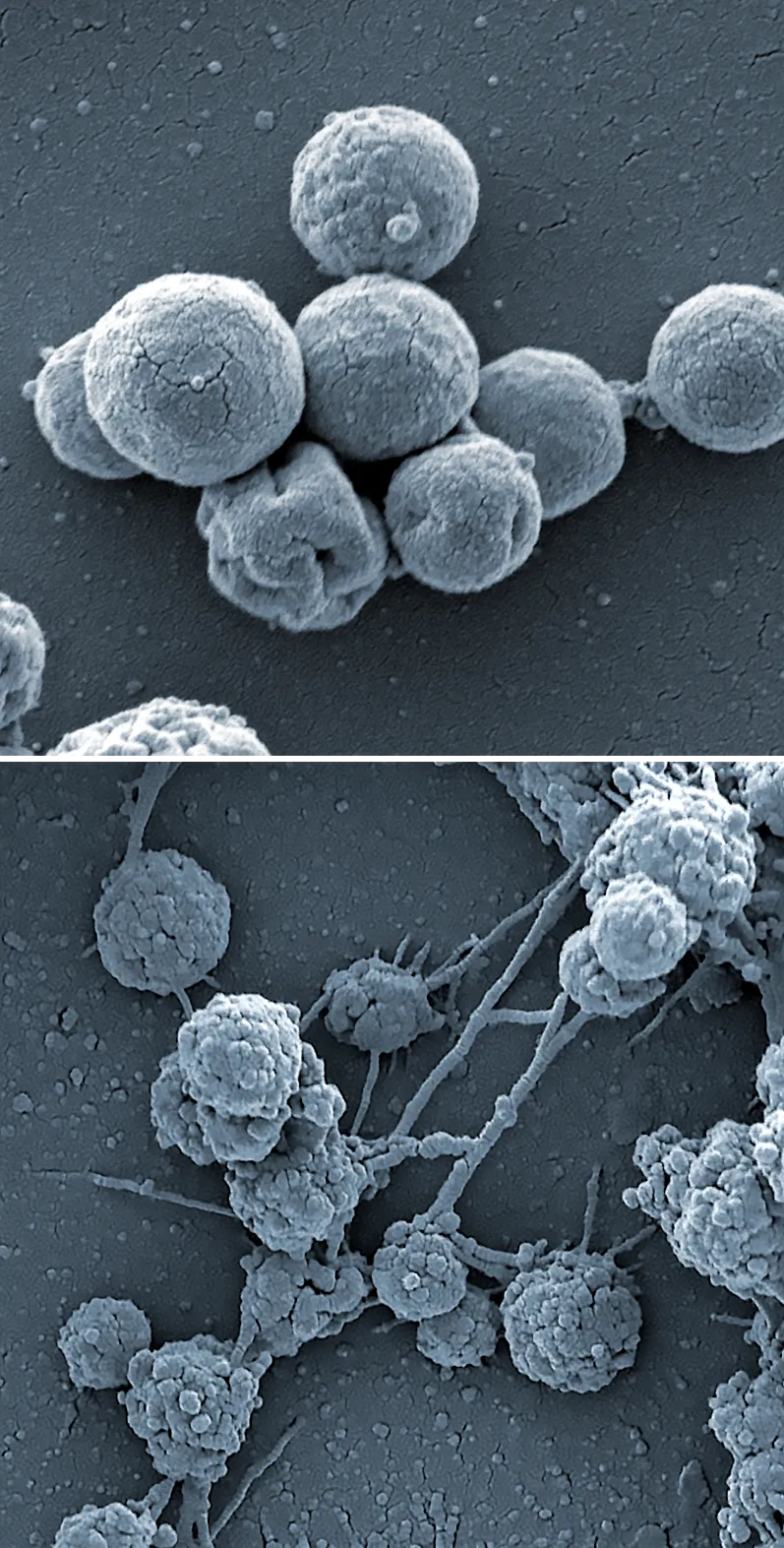 Comparison of two micrographs showing spherical cells. The cells in the first image are slightly larger..