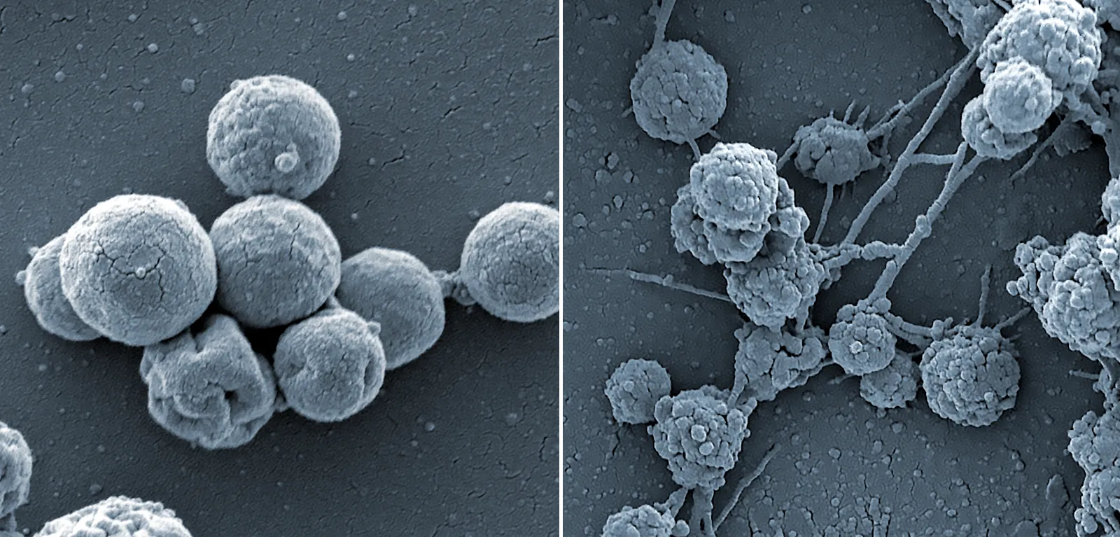 Comparison of two micrographs showing spherical cells. The cells in the first image are slightly larger.