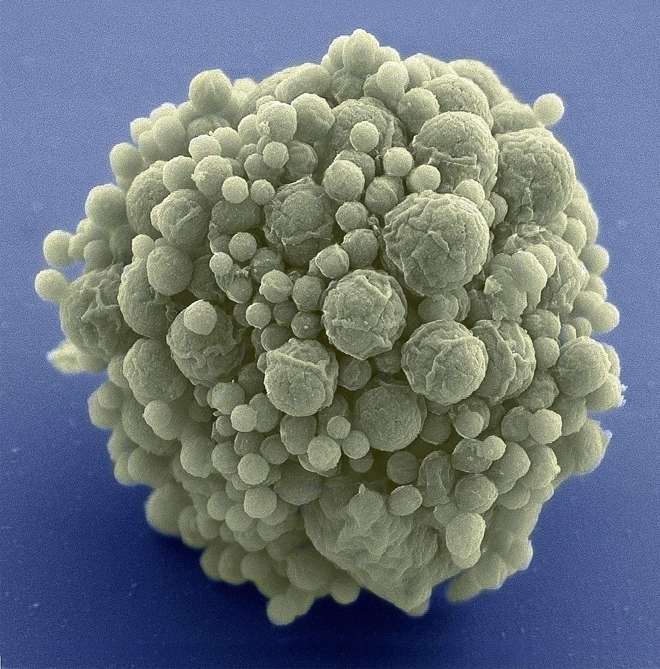 A cluster of globular cells against a light background.