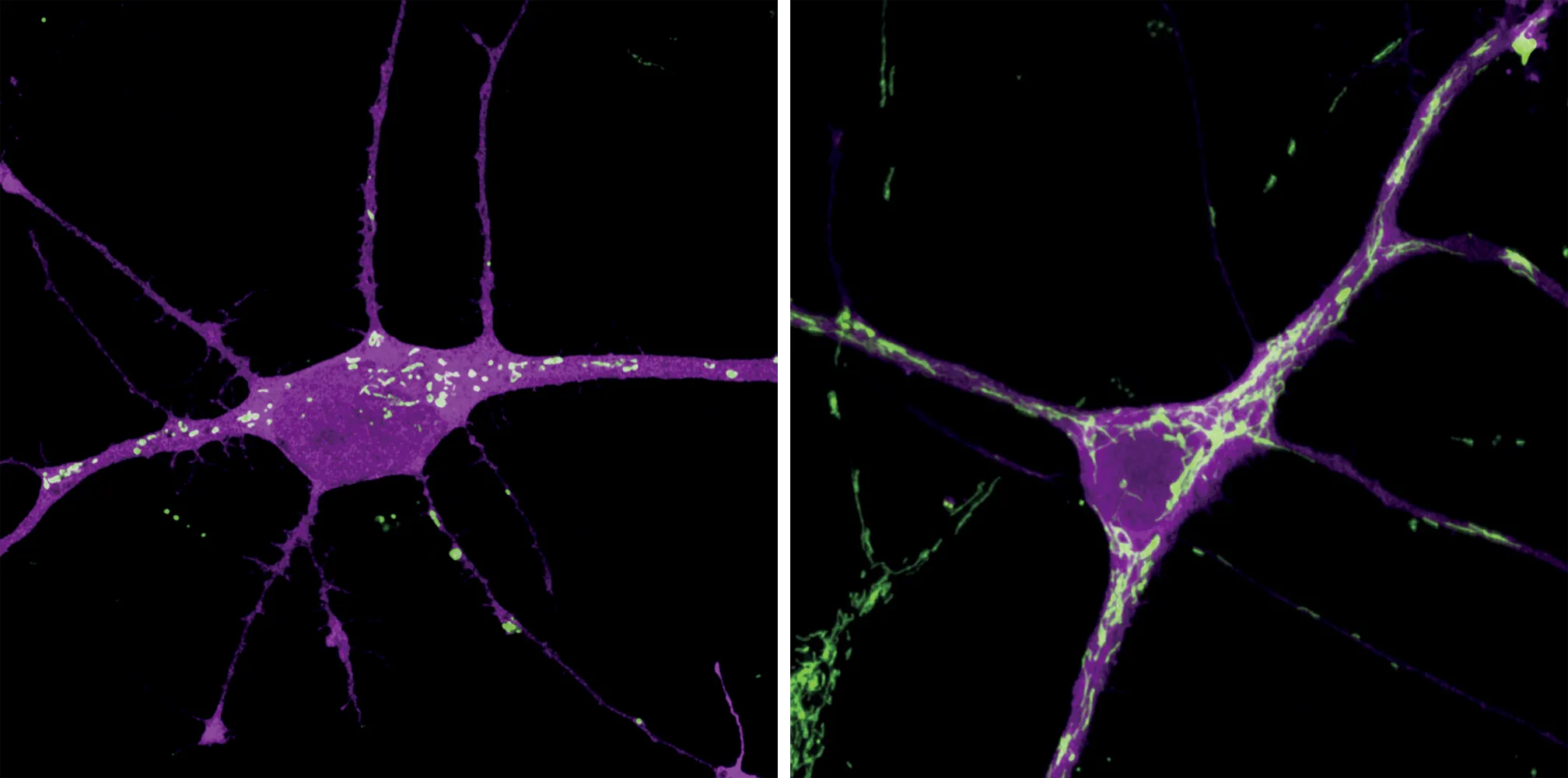 A pair of microscopic images of an immature and mature neuron, with the mitochondria stained green. The mitochondria in the immature neuron are long and skinny; in the mature neuron, they are small, rounded and clearly defined.