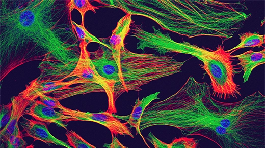 Astrocytes from the brain of a mouse are stained in neon colors that emphasize their stretched, starlike shape.