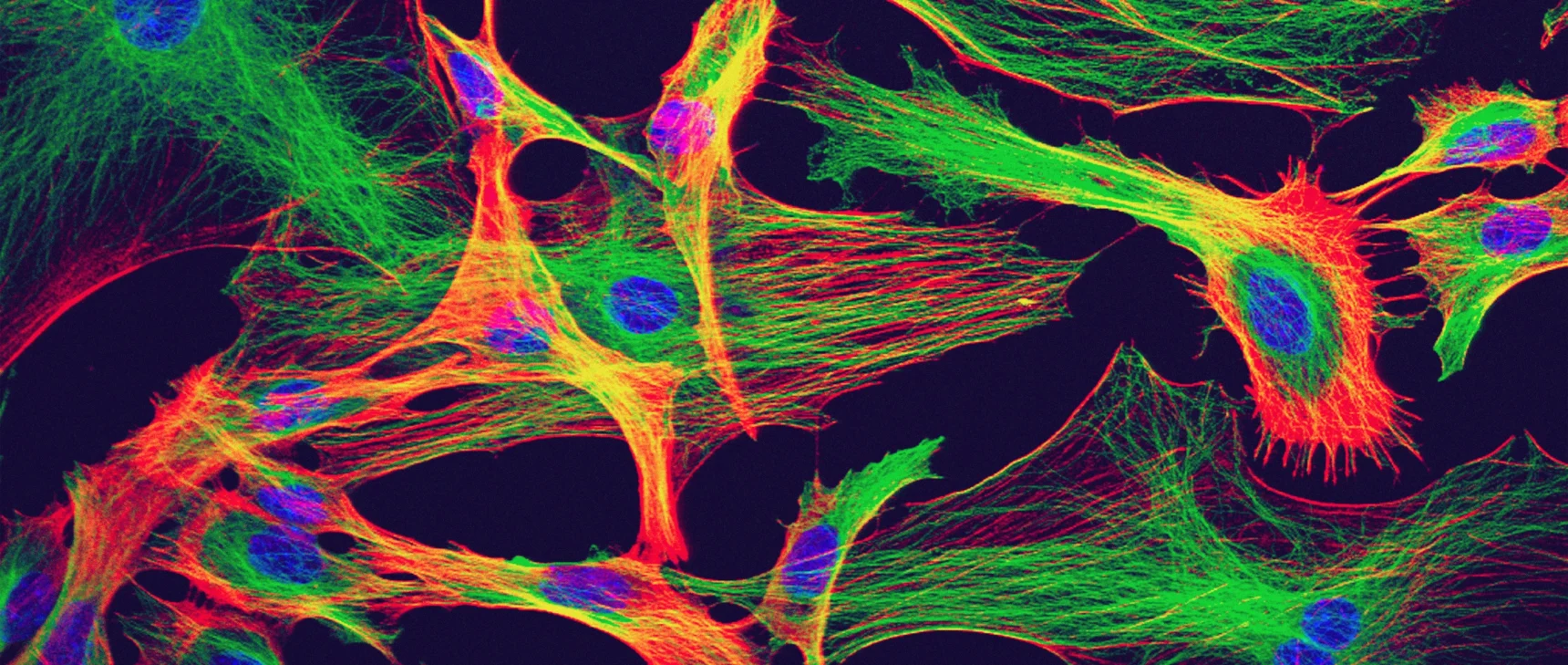 Astrocytes from the brain of a mouse are stained in neon colors that emphasize their stretched, starlike shape.