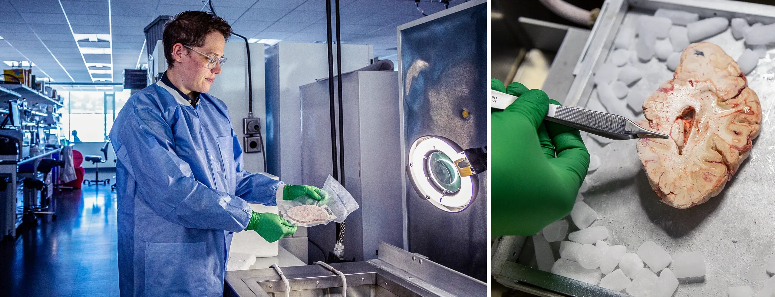 Rebecca Hodge studies a pink slice of a human brain, which sits on ice.