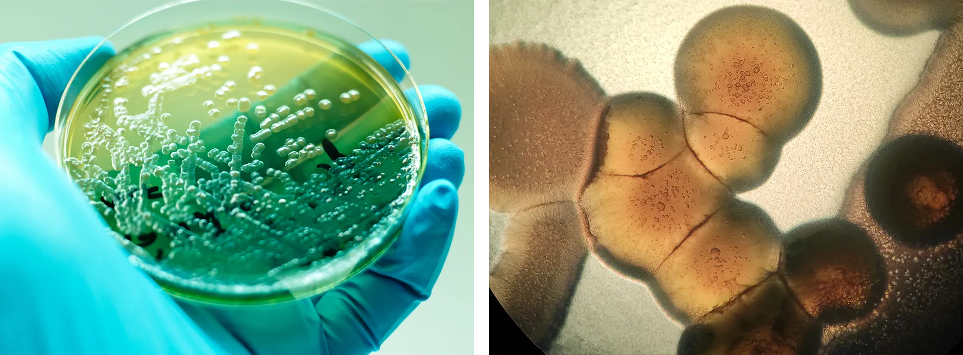 The bacterial species Pseudomonas aeruginosa, which forms a biofilm in the lungs of cystic fibrosis patients, is shown two ways: On the left it appears as streaks on a petri dish held in a gloved hand; on the right, it appears in an image from a microscope showing cells close-up.