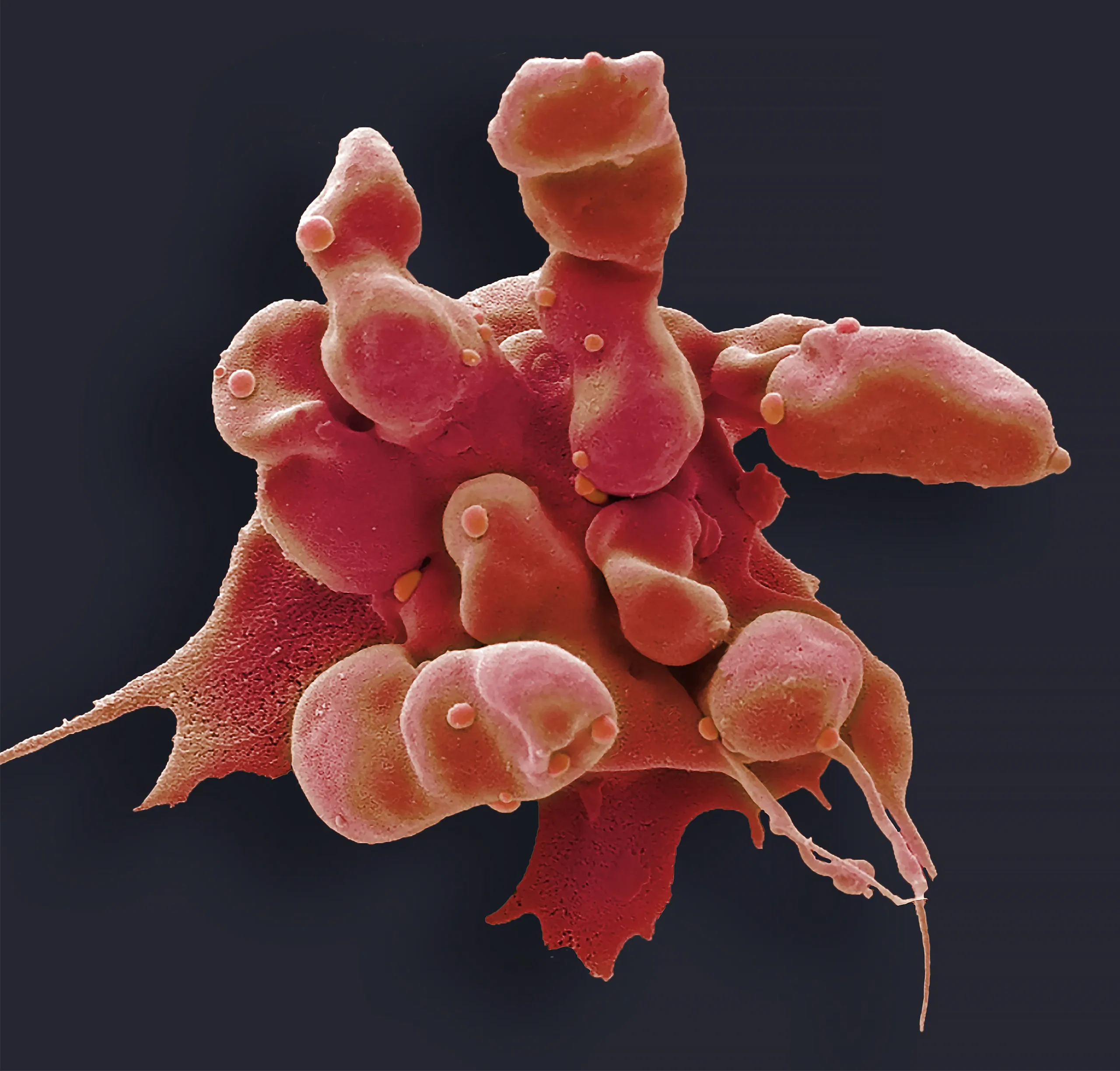 A red-colored cell membrane forms elongated bubbles, a sign of apoptosis.