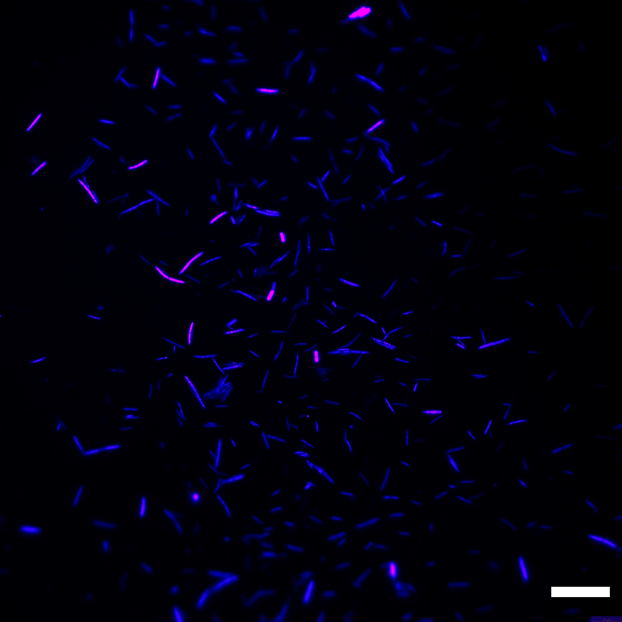 Rod-shaped blue bacteria against a black background. Some of the bacteria glow with pink patches.