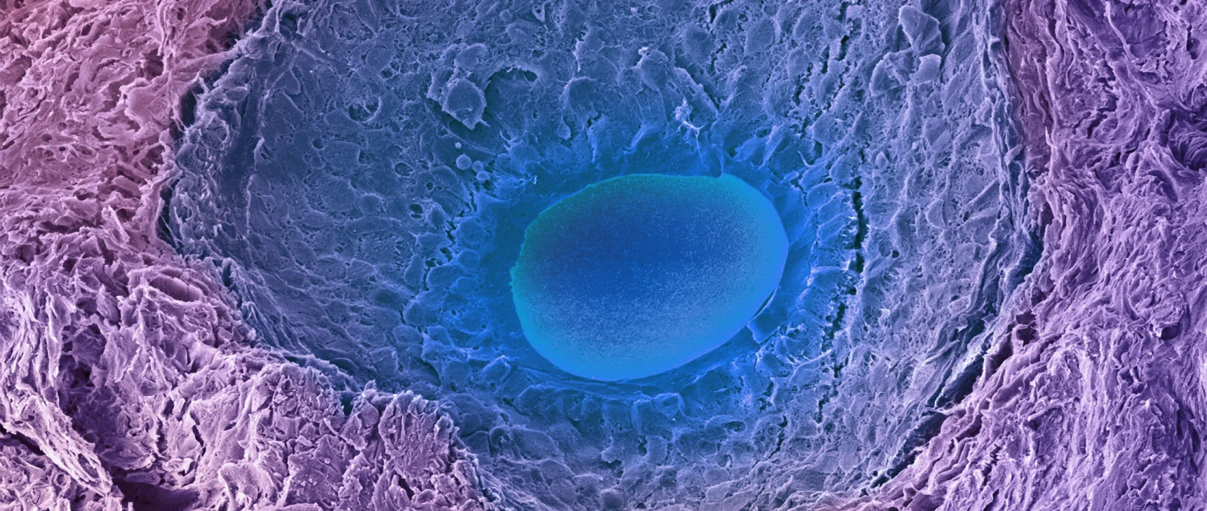 A colored scanning electron micrograph of a developing egg in an ovary follicle. The developing egg (oocyte) is a wide, flat oval sitting on a field of follicular cells.