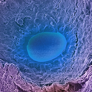 A colored scanning electron micrograph of a developing egg in an ovary follicle. The developing egg (oocyte) is a wide, flat oval sitting on a field of follicular cells.