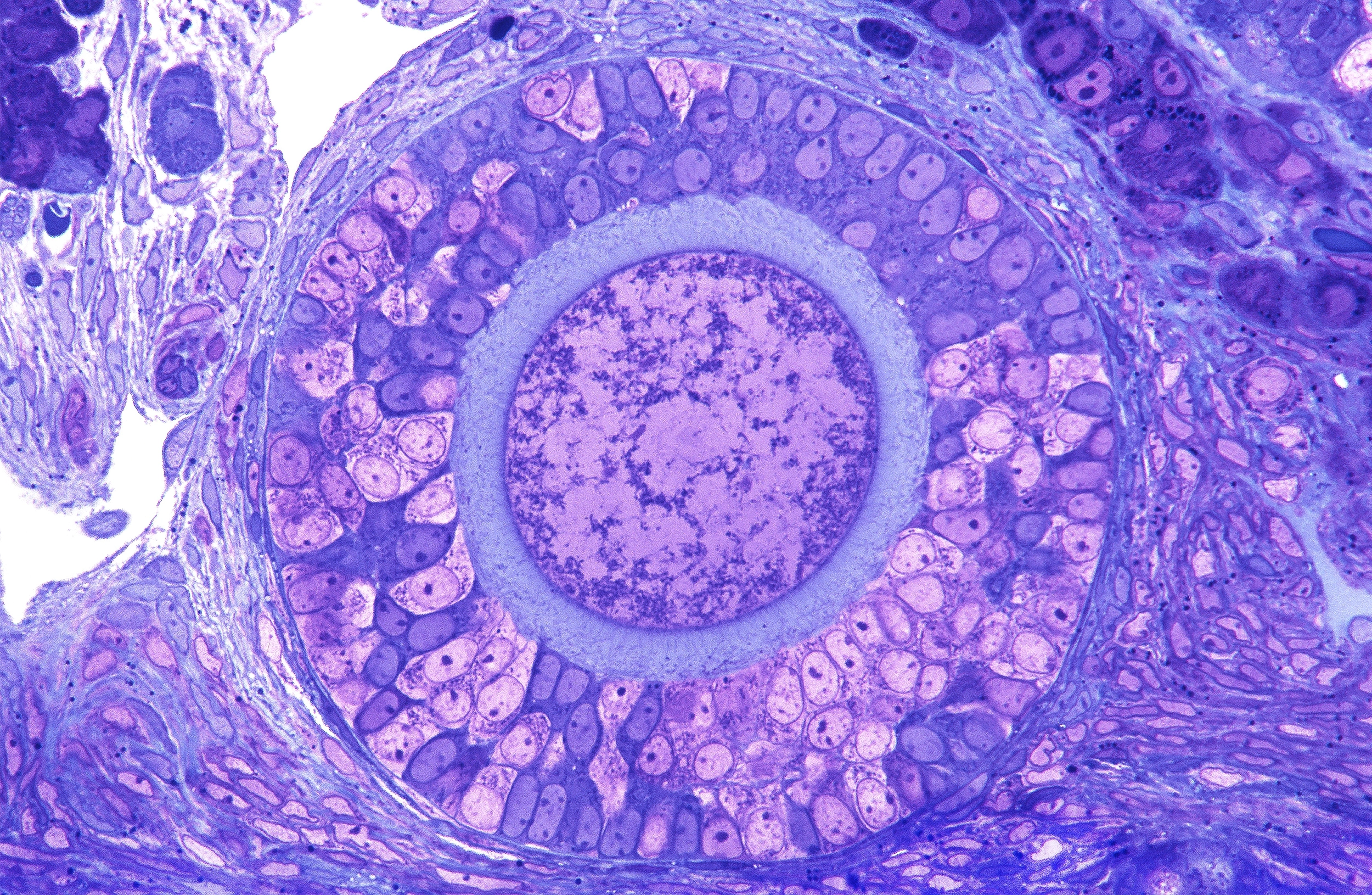 Light microscopy image of a growing ovarian follicle, stained purple. The oocyte sits amid a ring of granulosa cells.