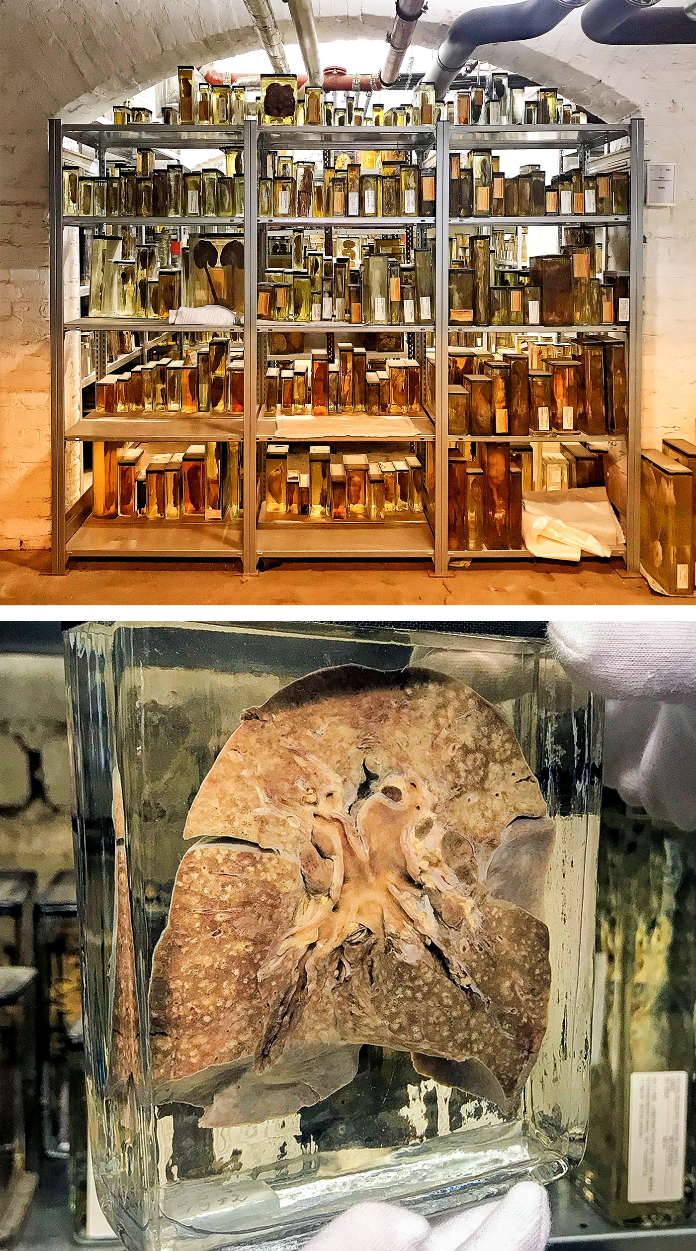 A shelf is stacked with glass jars — medical specimens preserved in formalin. Bottom: A preserved lung in a jar.