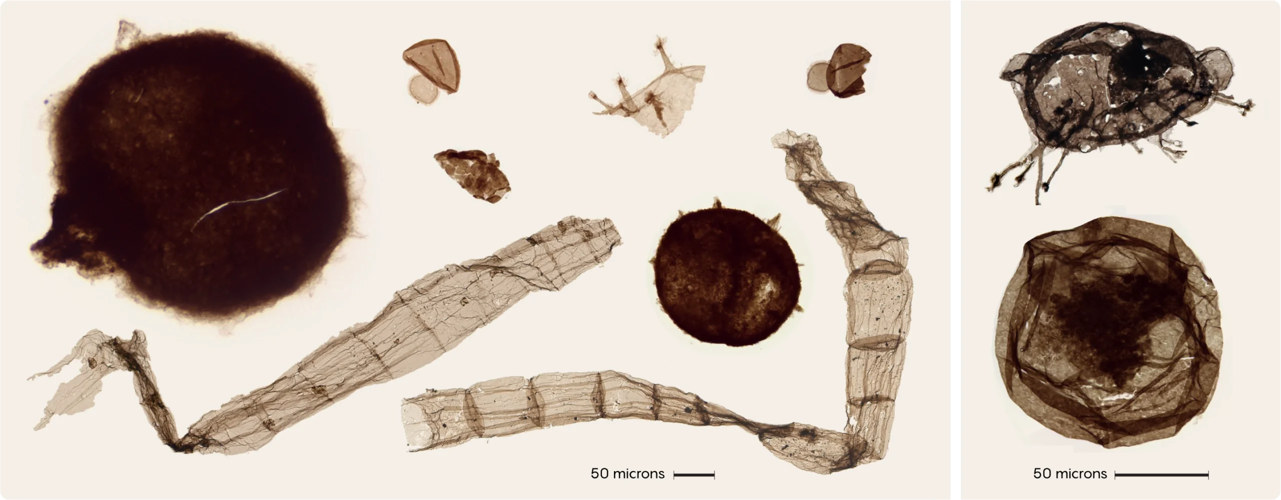 A selection of fossils of microscopic eukaryotic cells, which look like brown raisins. Tappania plana looks like a squished bug, or a raisin with legs.