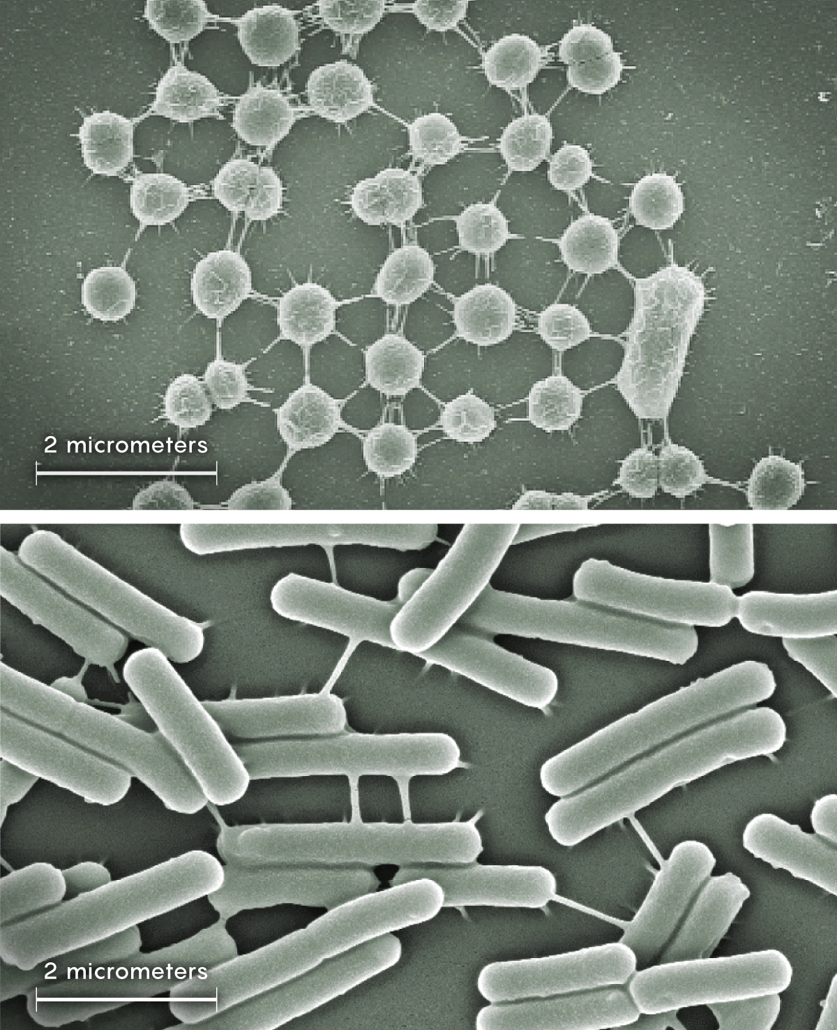 top: In a microscope image, thin tubes stretch between long, narrow, pill-shaped bacteria. Bottom: In a microscope image, thin tubes connect some two dozen round cyanobacteria.