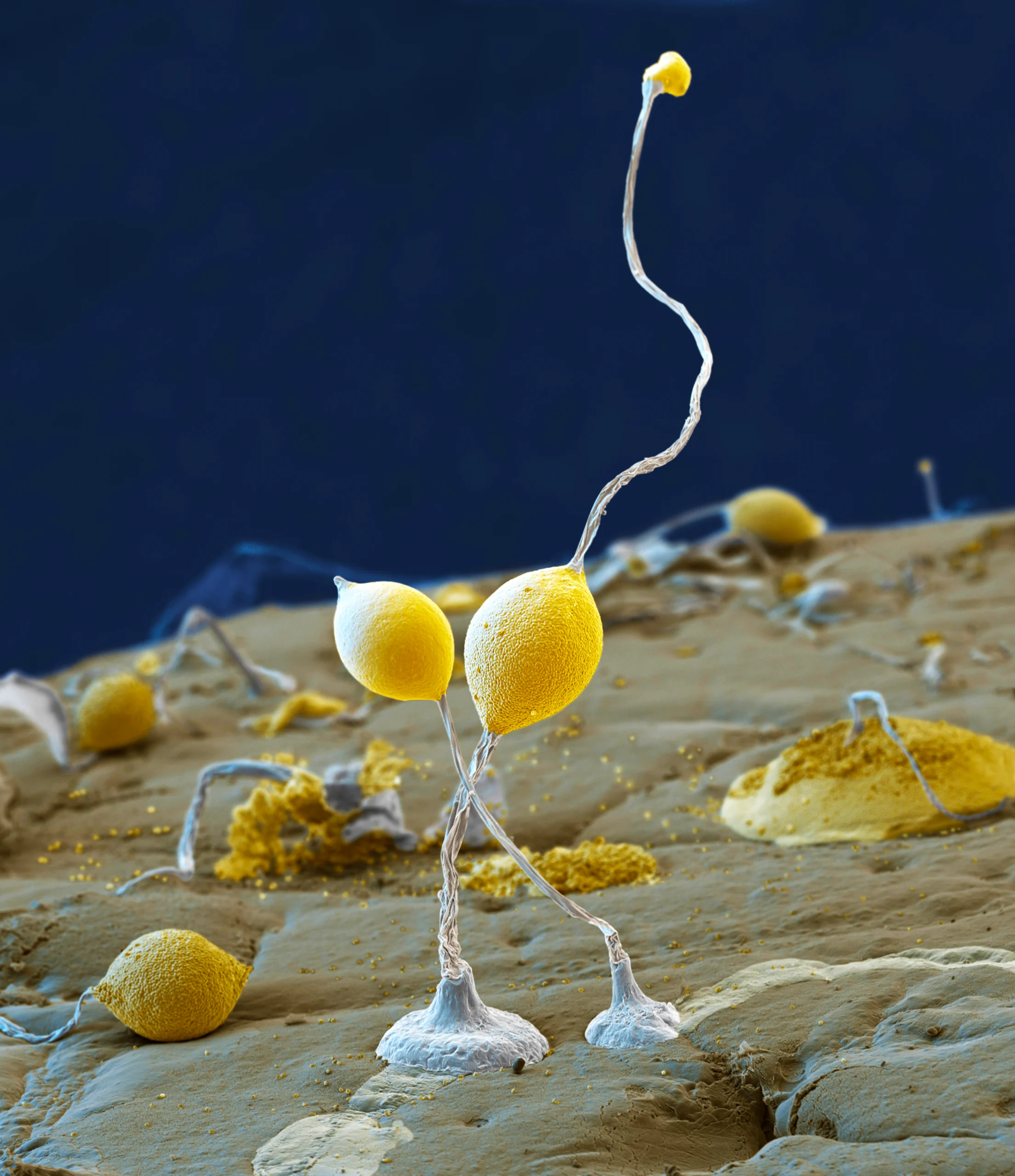 A Dictyostelium slime mold fruiting body looks like a long wire sprouting from the ground with a bulbous tip.