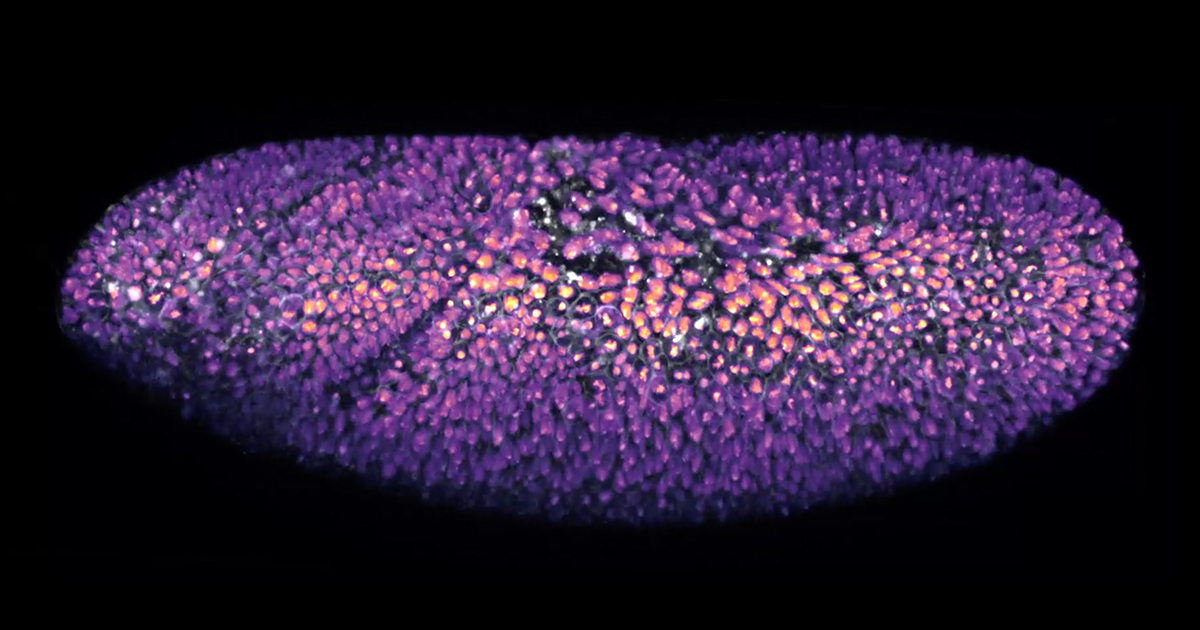 Metabolism Can Shape Cells' Destinies