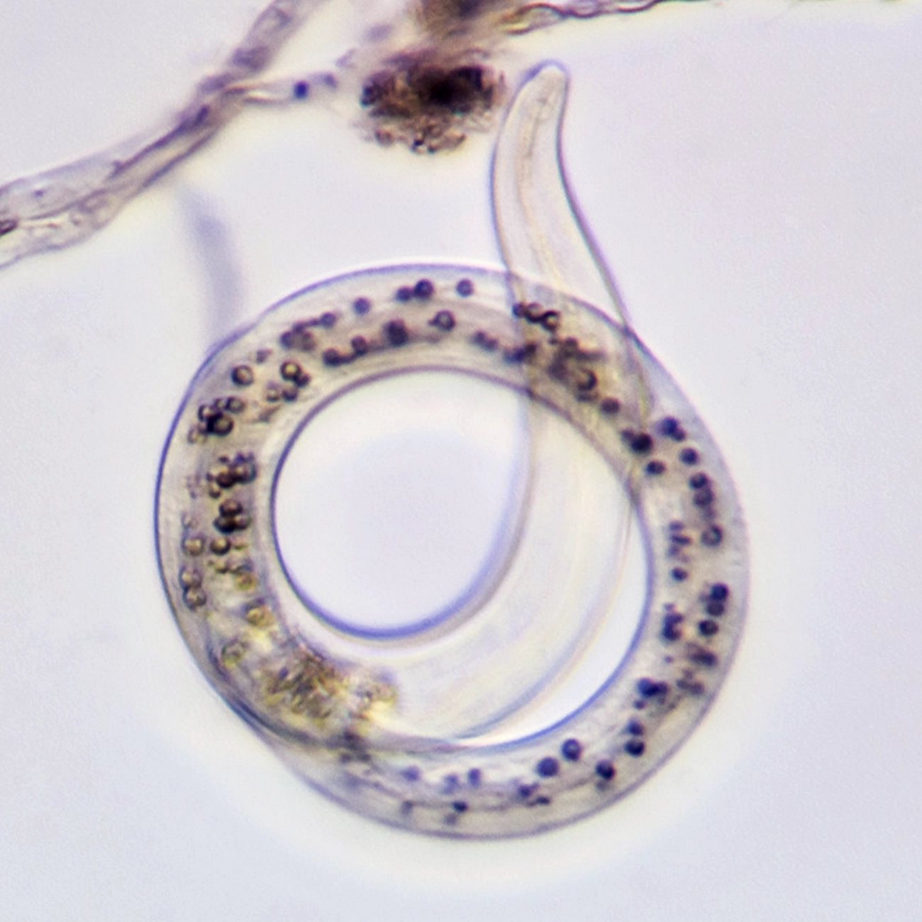 Micrograph of a nematode curling in a spiral.